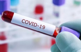 Reportan 172 nuevos contagios de Covid en la ciudad