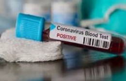 Coronavirus en Berisso: No hubo casos positivos y se sumaron 17 sospechosos