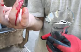 Recolector herido por vidrios mal descartados en la bolsa de basura
