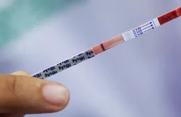 Jornada de Testeos en la Semana de las Hepatitis Virales